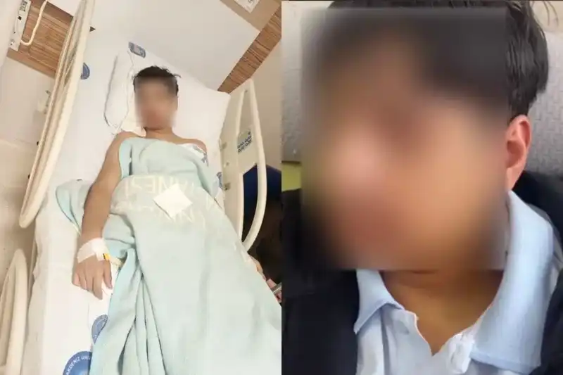 Antalya'da Akran Zorbalığı: Bir Çocuk Arkadaşının Çenesini Kırdı!