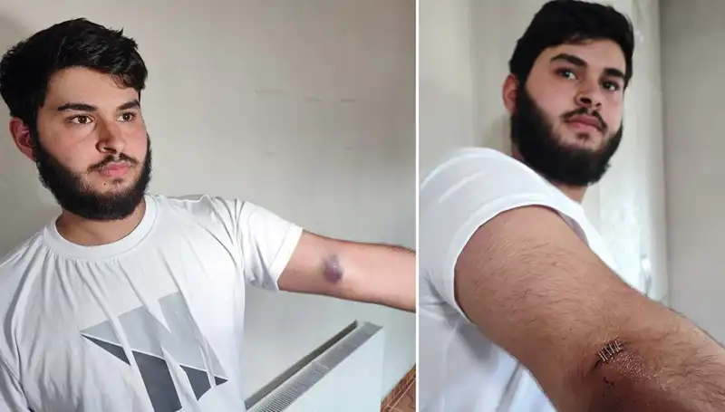 Mahallede Gergin Anlar: Bahçeye Kaçan Top için Gelen Conolar