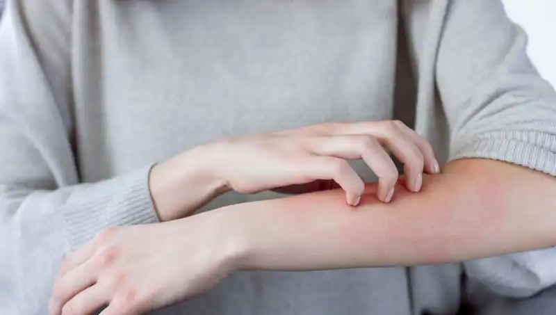 Cilt Kanserinin Sinsi Belirtileri: Dermatolog İki Özelliği Açıkladı