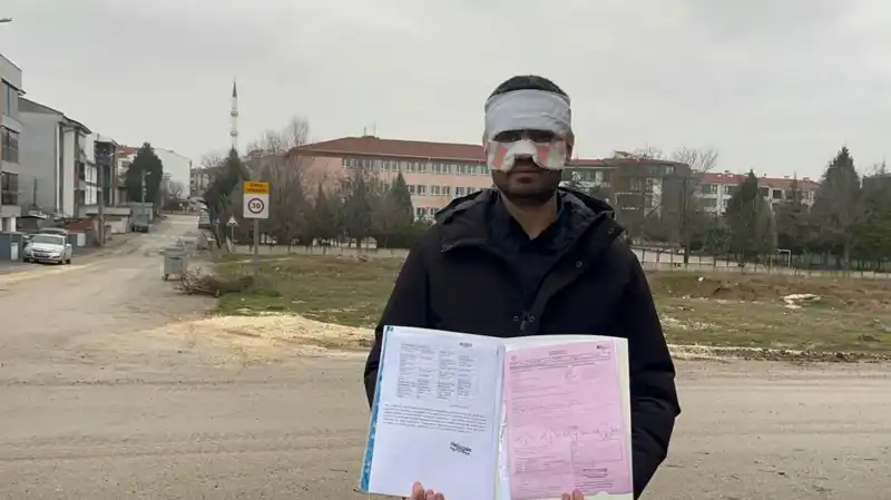 Öğretmenlerden Şok Şiddet Olayı: Yüzüne Sıcak Çay Fırlatıldı!