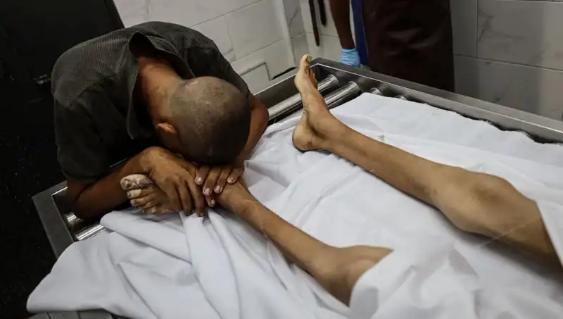 Gazze'deki Açlık Krizi: Bir Çocuk Daha Hayatını Kaybetti